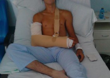 Un coche de choque secciona un nervio del brazo a un niño