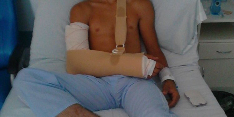 Un coche de choque secciona un nervio del brazo a un niño