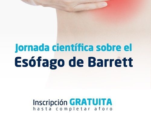 Fátima dedica su próxima jornada científica al Esófago de Barrett