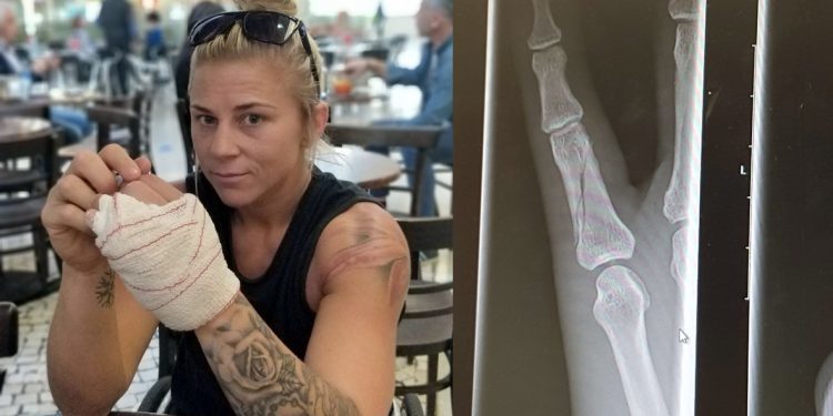 Cronau regresa con un dedo roto y será baja durante al menos quince días