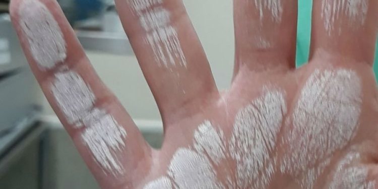 O Meixoeiro recupera a totalidade da actividade cirúrxica tralos problemas de esterilización