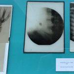 Historias de la medicina viguesa 1