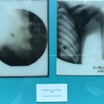 Historias de la medicina viguesa 4