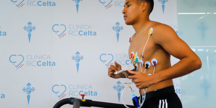 Los jugadores del Celta pasarán las pruebas PCR de Covid-19 este miércoles