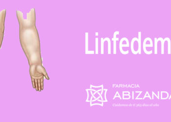 Linfedema, secuelas del cáncer de mama