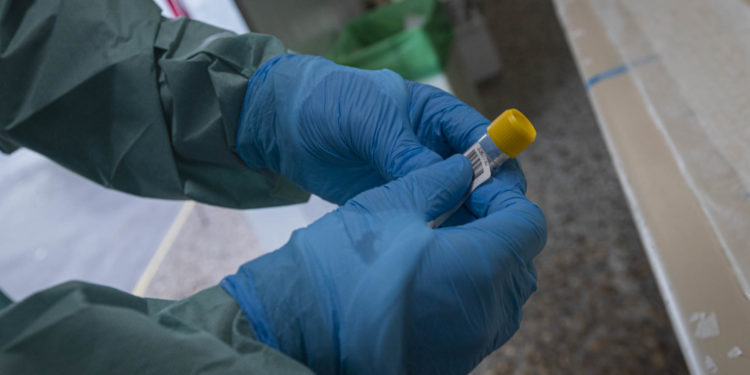 El área sanitaria de Vigo registra 3 fallecidos y ya suma un total de 18 víctimas esta semana