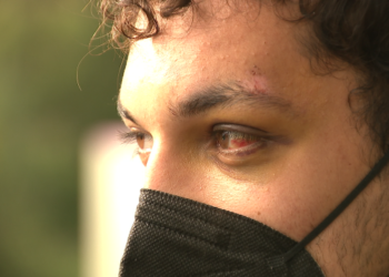 Un detenido por la paliza a un universitario en Vigo