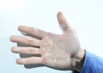 Tres detenidos en Vigo por robar en viviendas quitándose las huellas dactilares