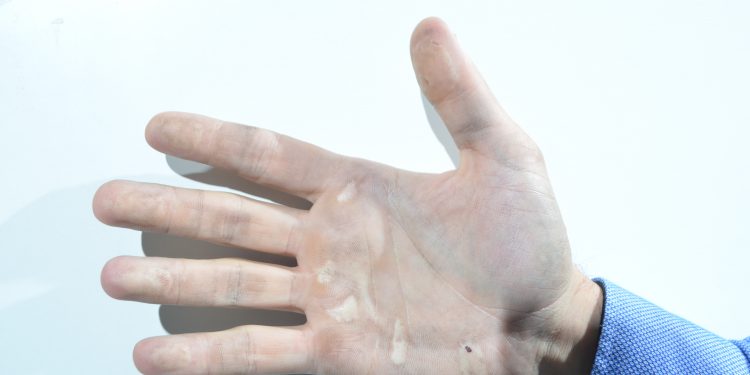 Tres detenidos en Vigo por robar en viviendas quitándose las huellas dactilares