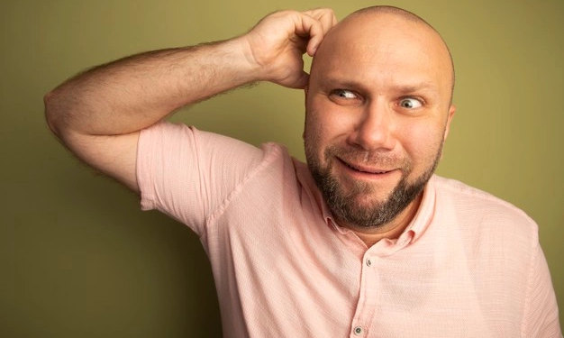 Conoce la técnica de injerto capilar que puede cambiar tu vida