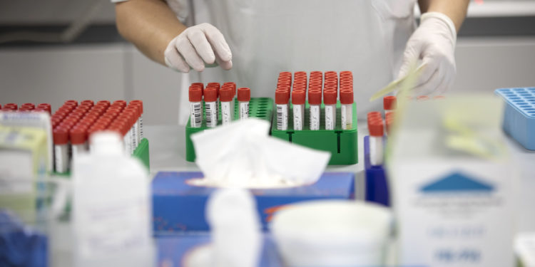 Tres nuevos positivos en Vigo elevan a doce los casos de la variante ómicron en Galicia