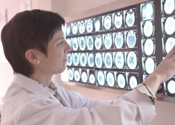 Más del 80% de los hospitalizados con coronavirus pueden presentar síntomas neurológicos