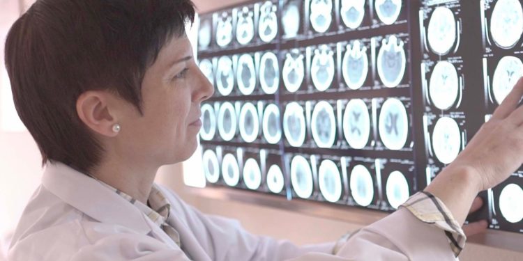 Más del 80% de los hospitalizados con coronavirus pueden presentar síntomas neurológicos