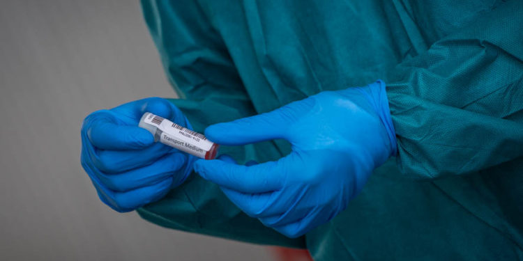 Galicia suma dos casos sospechosos de viruela del mono tras dar negativo los tres anteriores