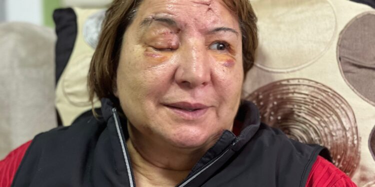 «Pensé que no iba a volver a ver a mis hijos y mi nieta, que no iba a llegar a cumplir los 63 años»