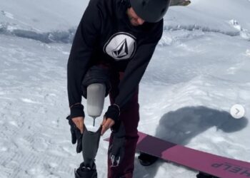 Un joven de Cuntis lanza un crowdfunding para comprar una prótesis deportiva y poder competir