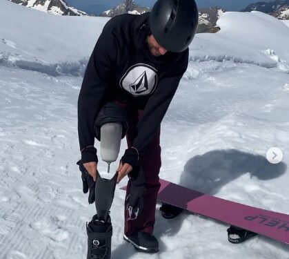 Un joven de Cuntis lanza un crowdfunding para comprar una prótesis deportiva y poder competir