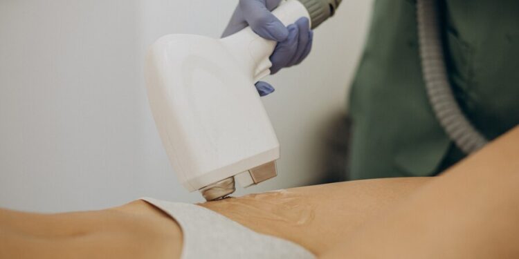 Centros bedda, la excelencia en depilación láser en Vigo y el norte de España